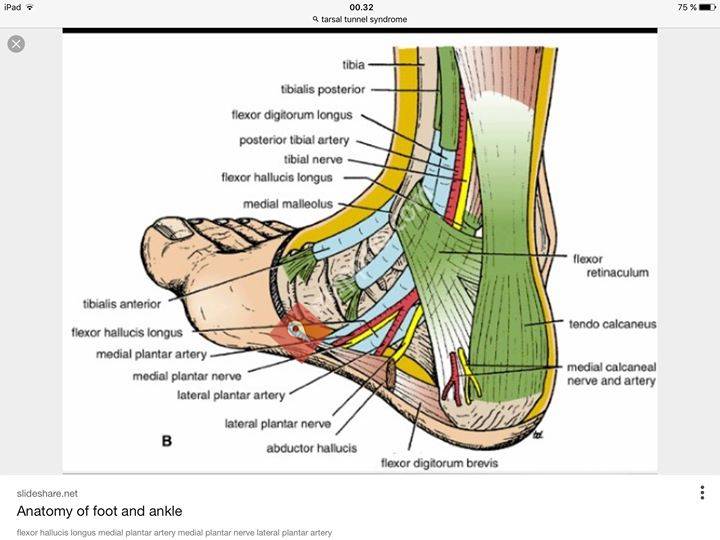 Polarsirkelen Fysioterapi
